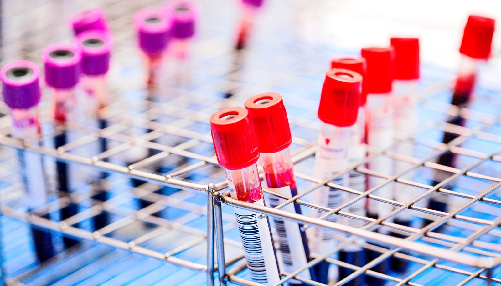 Blood tests can spot cancer 3 years before it’s found